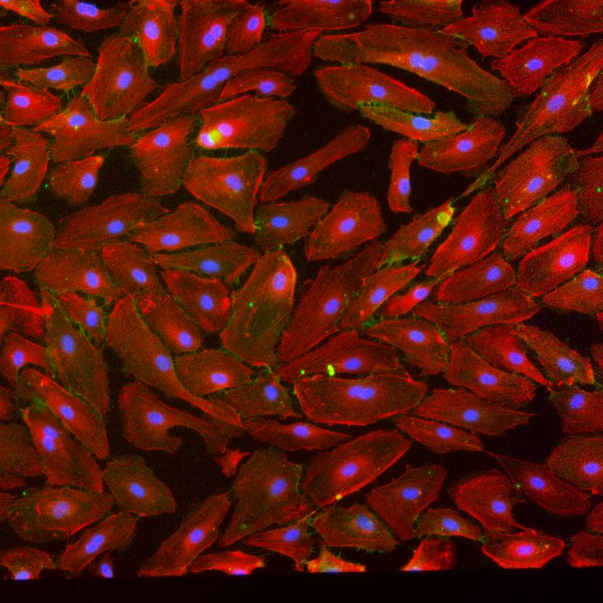 Cell Culture & Assay