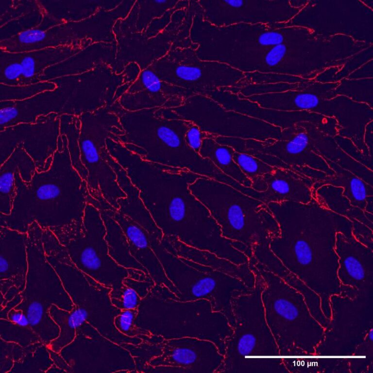 Cell Culture Assay & Imaging SiMPore