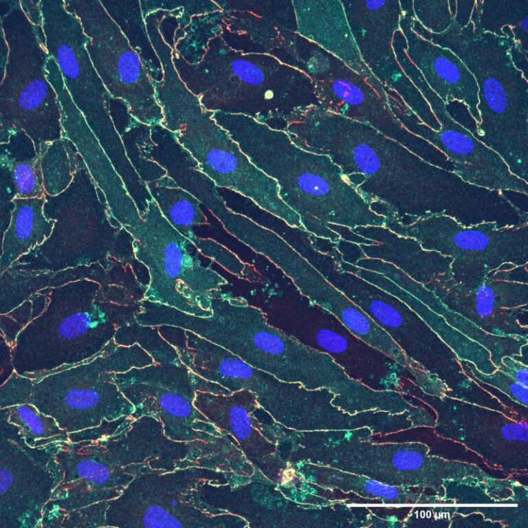 Cell Culture Assay & Imaging SiMPore