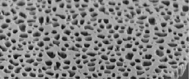 Transmission Electron Microscopy